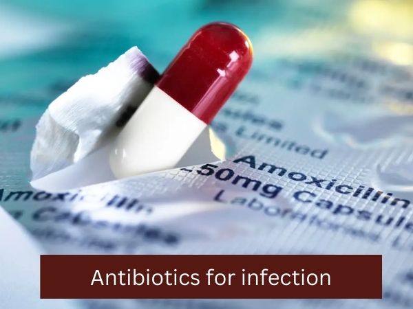 Antibiotics for infection